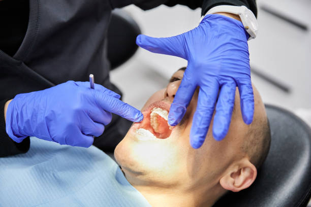 Best Dental Abscess Treatment in Marlette, MI